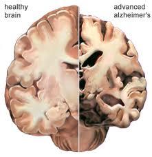 Brain